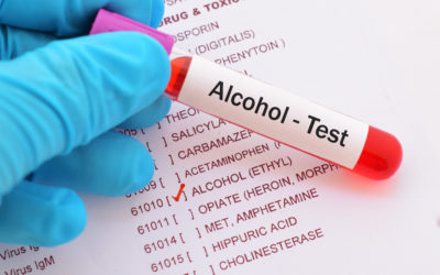 ETG Alcohol Tests: 9 Things You Need to Know