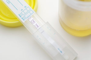 What Are The Different Types of Instant Drug Testing Kits?