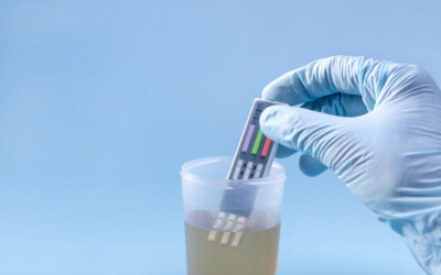 What are Adulterants and Adulteration Strips for Drug Testing Supplies?