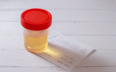 12 Panel Drug Tests: Reasons Why Using 12 Panel Is Recommended